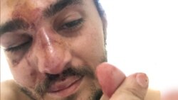 Georgian Civil Activist Bruised And Bloodied, Opposition's Homes, Offices Vandalized Georgian Civil Activist Bruised And Bloodied, Opposition's Homes, Offices Vandalized