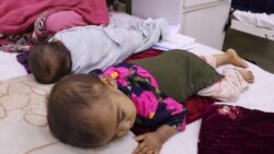 Afghan Hospital Sees Malnutrition Spike As UN Warns 875,000 Children At Risk Afghan Hospital Sees Malnutrition Spike As UN Warns 875,000 Children At Risk