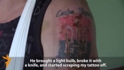 Ukrainian Miner Describes Torture In Rebel Captivity Ukrainian Miner Describes Torture In Rebel Captivity